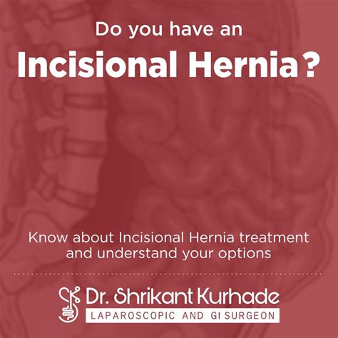Dr Shrikant Kurhade Laparoscopic Gastroenterologist Bariatric Hernia Piles Specialist In Pimpri