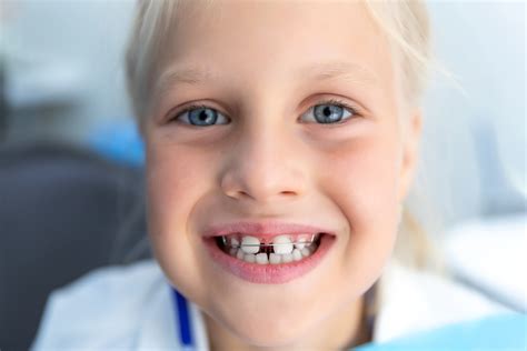 Can You Get Braces With Missing Teeth Houston Ortho