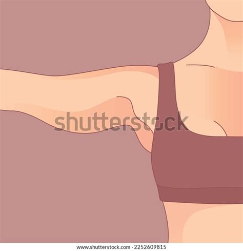 Arm Excess Skin Saggy Skin Removal Stock Vector Royalty Free 2252609815 Shutterstock