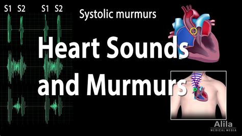 Heart Murmur Sounds Faculty Of Medicine