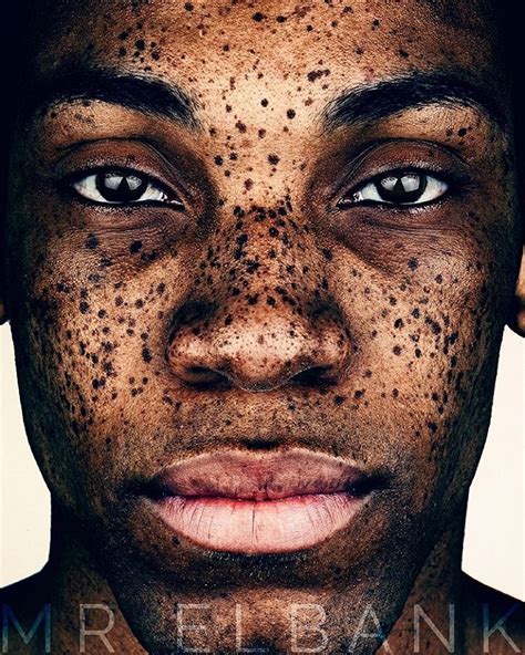 Stunning Portraits Celebrate The Unique Beauty Of Freckled Faces