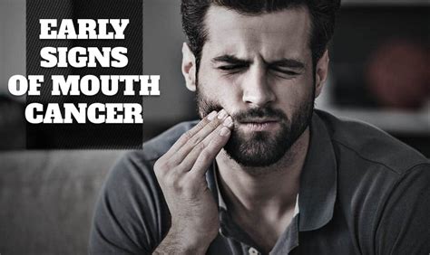 When to see a doctor. Early Signs of Mouth Cancer - BaccOff