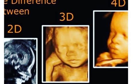 3d4d Ultrasound By Exceptional Imaging Center In Miramar Fl Alignable