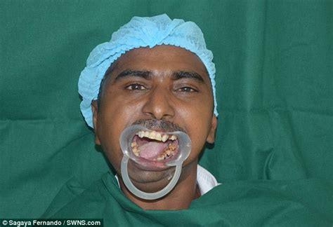 Malnourished Indian Man Eats Solid Food For The First Time Daily Mail Online