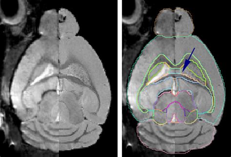 A The Coronal Axial And Sagittal Slices Of A 3d In Vivo Mri Mouse