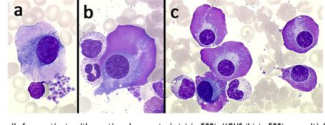 Plasma Cell Morphology In Multiple Myeloma And Related Disorders