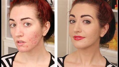 How To Cover Acne And Scarring My Full Coverage Foundation