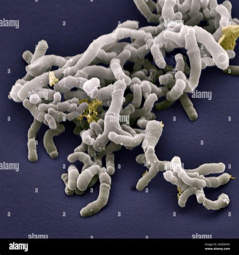 Bifidobacterium Bacteria Coloured Scanning Electron Micrograph Sem