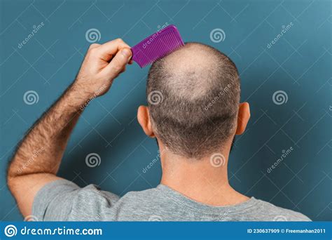 A Man Combs His Bald Head With A Comb Blue Background Rear View Stock