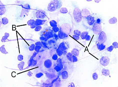 Cytology Sample From A Subcutaneous Mass On The Rear Limb Of The Horse
