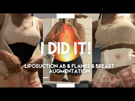 Plastic Surgery Vlog New Boobies And Liposuction Youtube