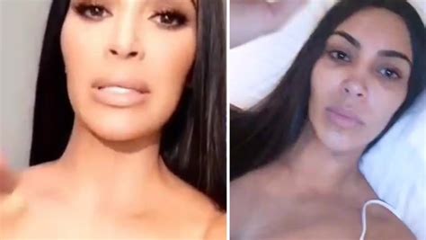 Real Life Sex Doll Mum Spent £10000 In A Year On Extreme Makeover Including Lip Injections
