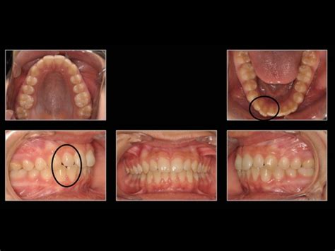Simple Science: How to Make a Volcano with Kids