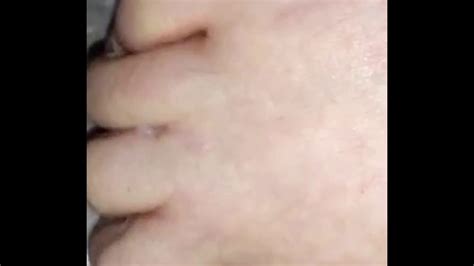 Really Strange Parasite Coming Out Of My Toe Iso Medical Help Youtube