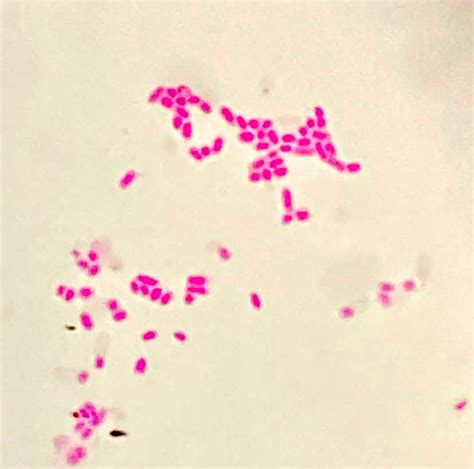 Difficulty Of Morphological Diagnosis In Gram Staining Bmj Case Reports