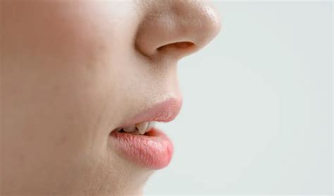 Angular Cheilitis How To Heal Cracked Lip Corners Fast Black Hills