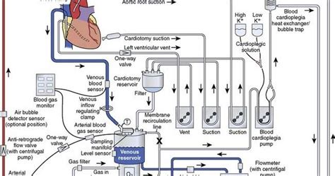 Cardiopulmonary Bypass Cpb Is A Technique That Temporarily Takes Over