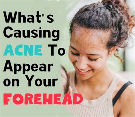 Whats Causing Acne To Appear On Your Forehead