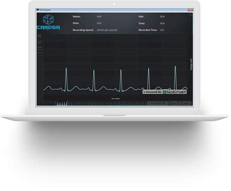 Dynamic Wpf Visualization Of Ecg Signals In Realtime Scichart The