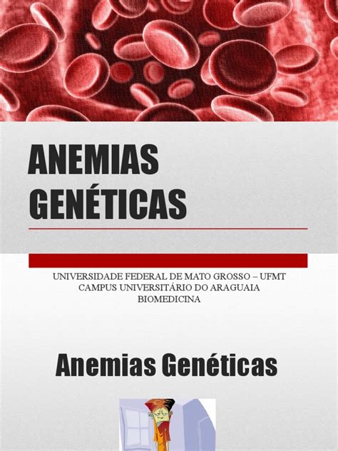 Anemias Genéticas Pdf Doença Falciforme Anemia