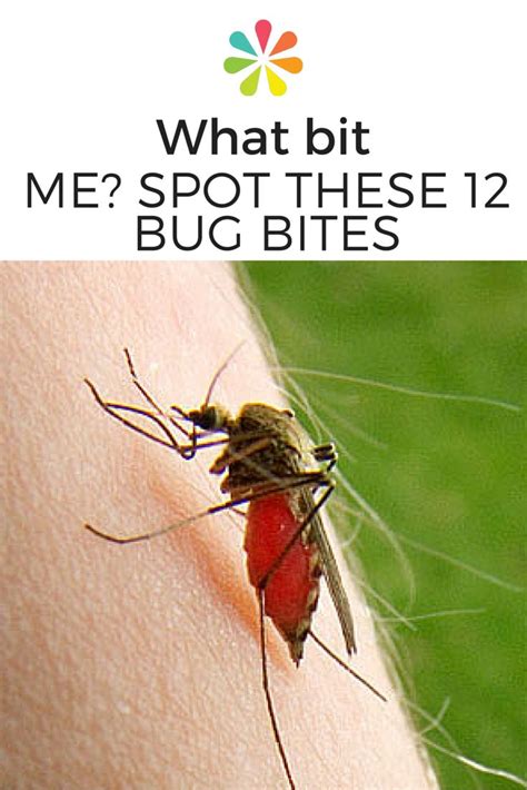 Learning To Identify A Bug Bite By How It Looks And Feels Will Help You