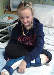 Danya Cope Lost Half Her Skull After Being Trapped Under Lorry Daily