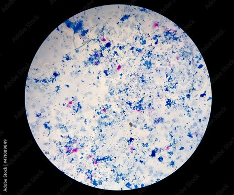 Sputum Smear Afb Stain Microscopic Close View Macrobacterium