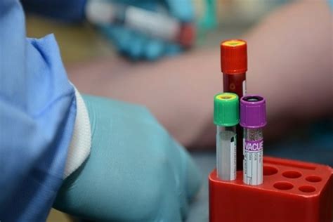Rapid Blood Test Could Detect Brain Injury In Minutes Study Shows