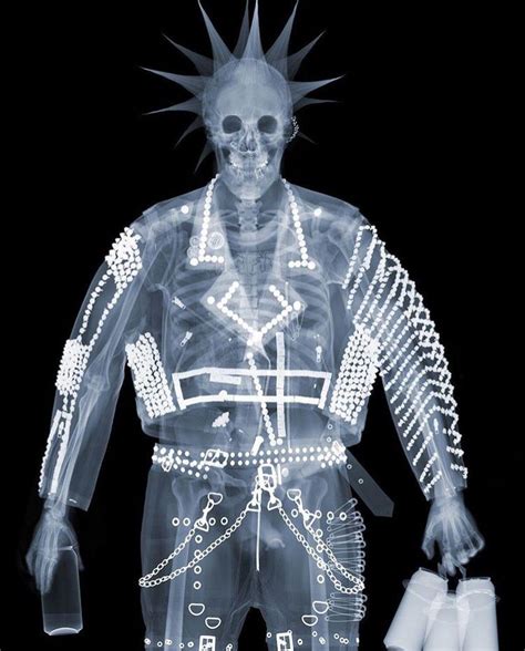 Skeleton Pfp Xray Art X Ray X Ray Images