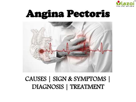 Ppt Angina Pectoris Causes Symptoms Diagnosis And Treatment