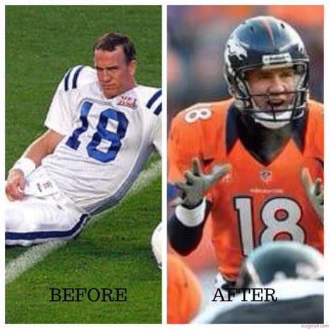 Peyton Manning Plastic Surgery Photos Before And After Surgery4
