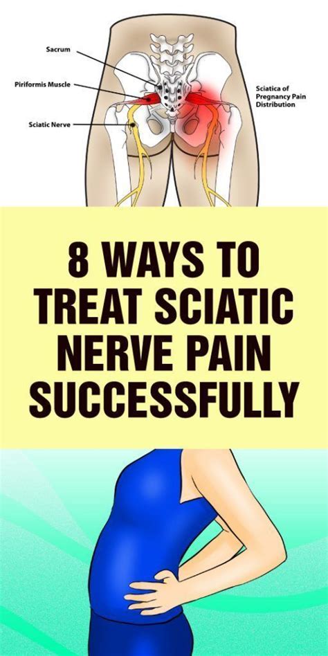 Easy Ways To Treat Sciatic Nerve Pain Successfully Sweet Oh Joy