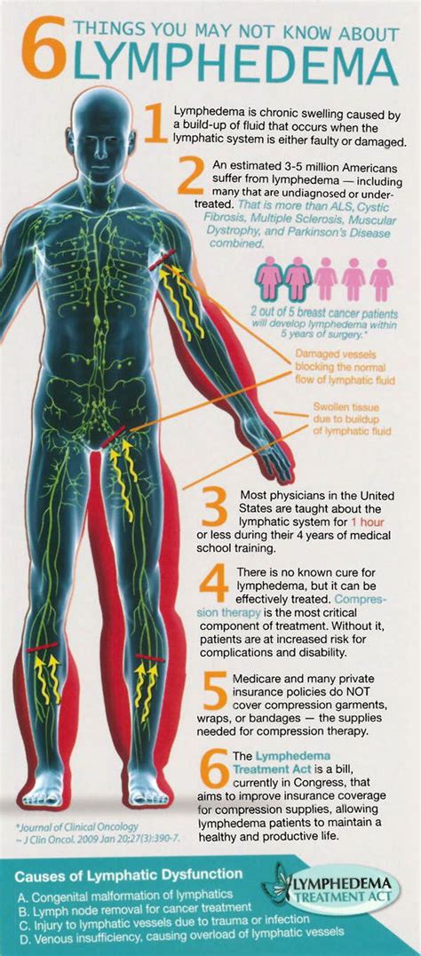 Lymphedema Treatment Artofit