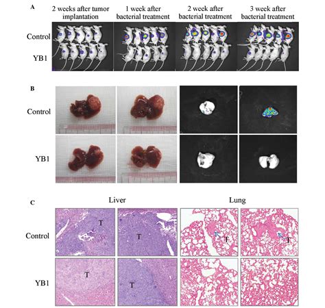 Obligate Anaerobic Salmonella Strain YB1 Suppresses Liver Tumor