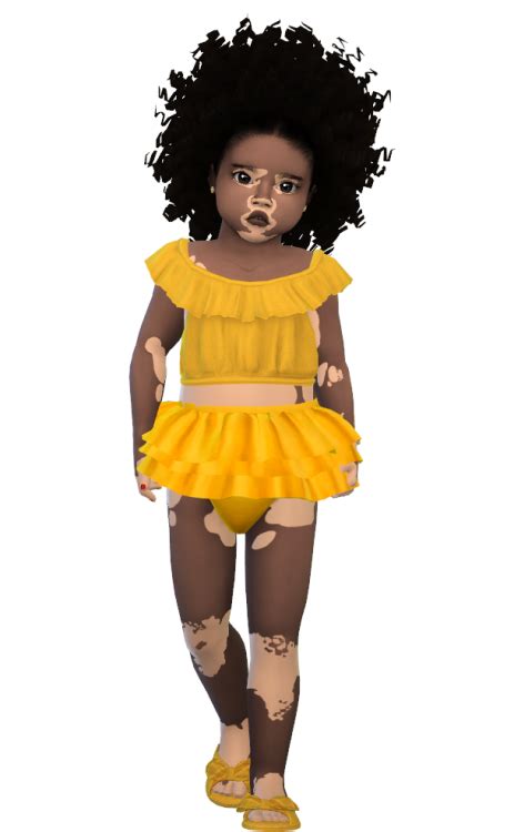 The Black Simmer Vitiligo For Toddlers By Sims4xs