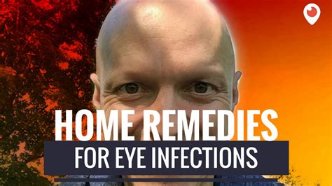 Home Remedies For An Eye Infection Youtube