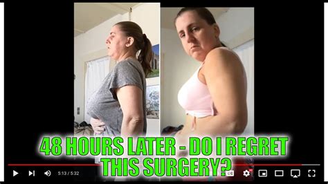 48 Hours Later Post Op Breast Reduction Youtube