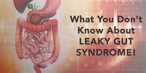 Do You Have Leaky Gut Syndrome Check Symptoms Here