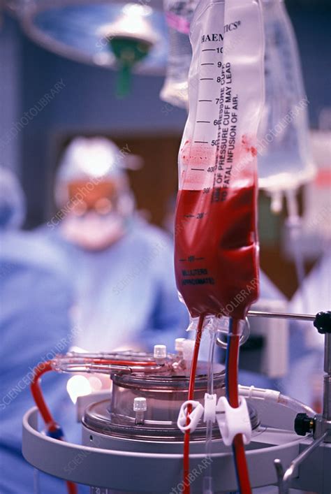 Blood is on the dance floor, blood is on the knife susie's got your number and susie says it's right #bloodonthedancefloor #michaeljackson #history. Blood Transfusion - Stock Image - M580/0298 - Science ...