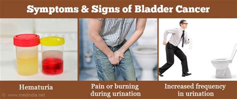 Symptoms And Signs Of Bladder Cancer Medical Tech News The Latest Health News