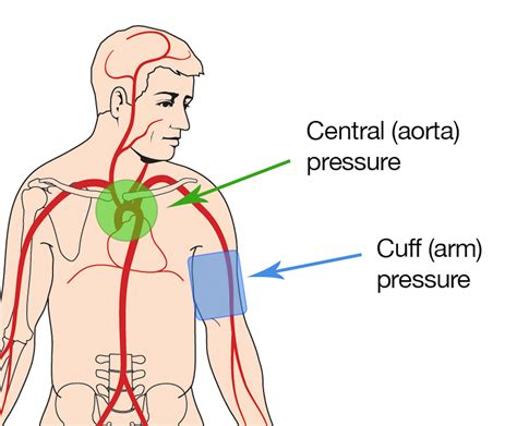 The Most Used Method Of Measuring Blood Pressure Is Often Inaccurate