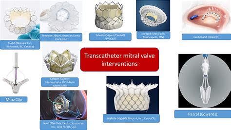 Frontiers Multimodality Imaging In Transcatheter Mitral Interventions