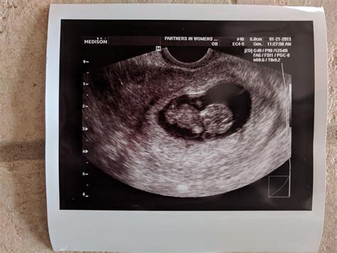 First Ultrasound For My First Child Rpredaddit