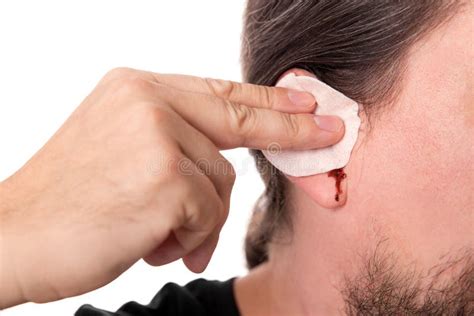 Man Having Ear Bleeding Isolated On White Concept Otitis Media Stock