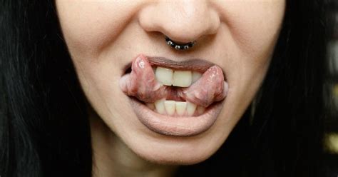 People Who Get Their Tongues Split Are Putting Their Lives At Risk