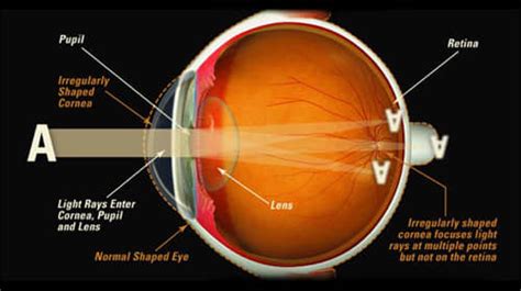 How The Eye Works Hubpages