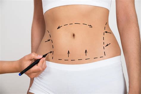 Belly Button Shaping Is The Latest Cosmetic Surgery Craze