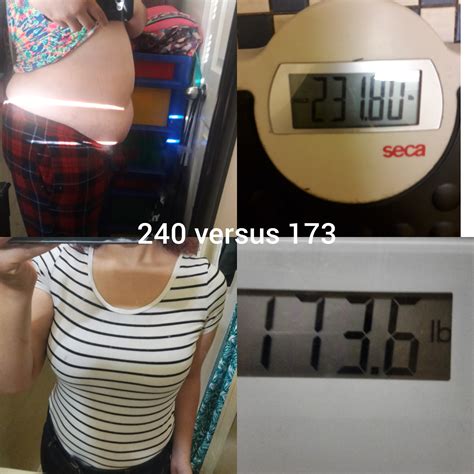 F20545 240 173 67 Lbs 1 Yr 2 Months Did Not Take A Scale