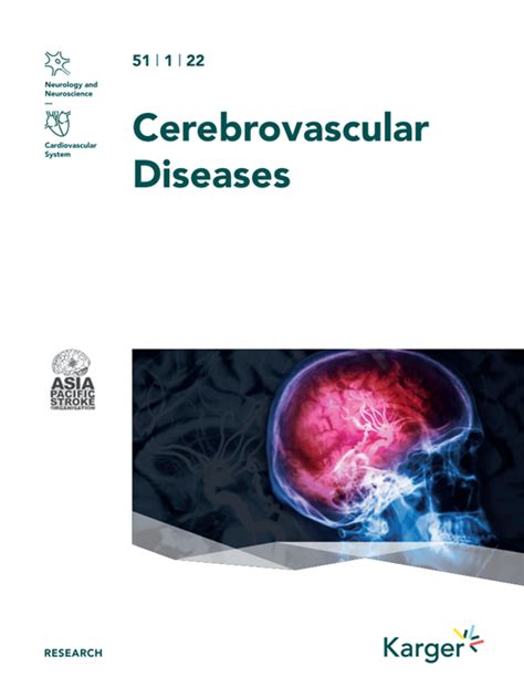 Contemporary Trends In The Treatment Of Mild Ischemic Stroke With