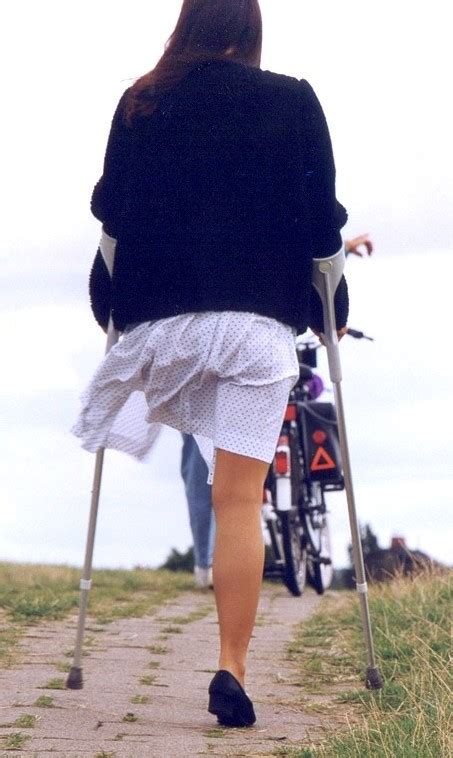 Blog Tražim ženu Bez Noge Amputacija Noge I Savremena ženska Monopodija